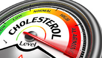 Cholesterin